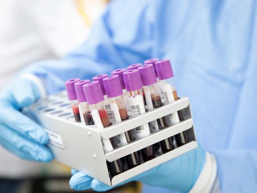 Buisjes bloed in een laboratorium voor diagnostisch onderzoek