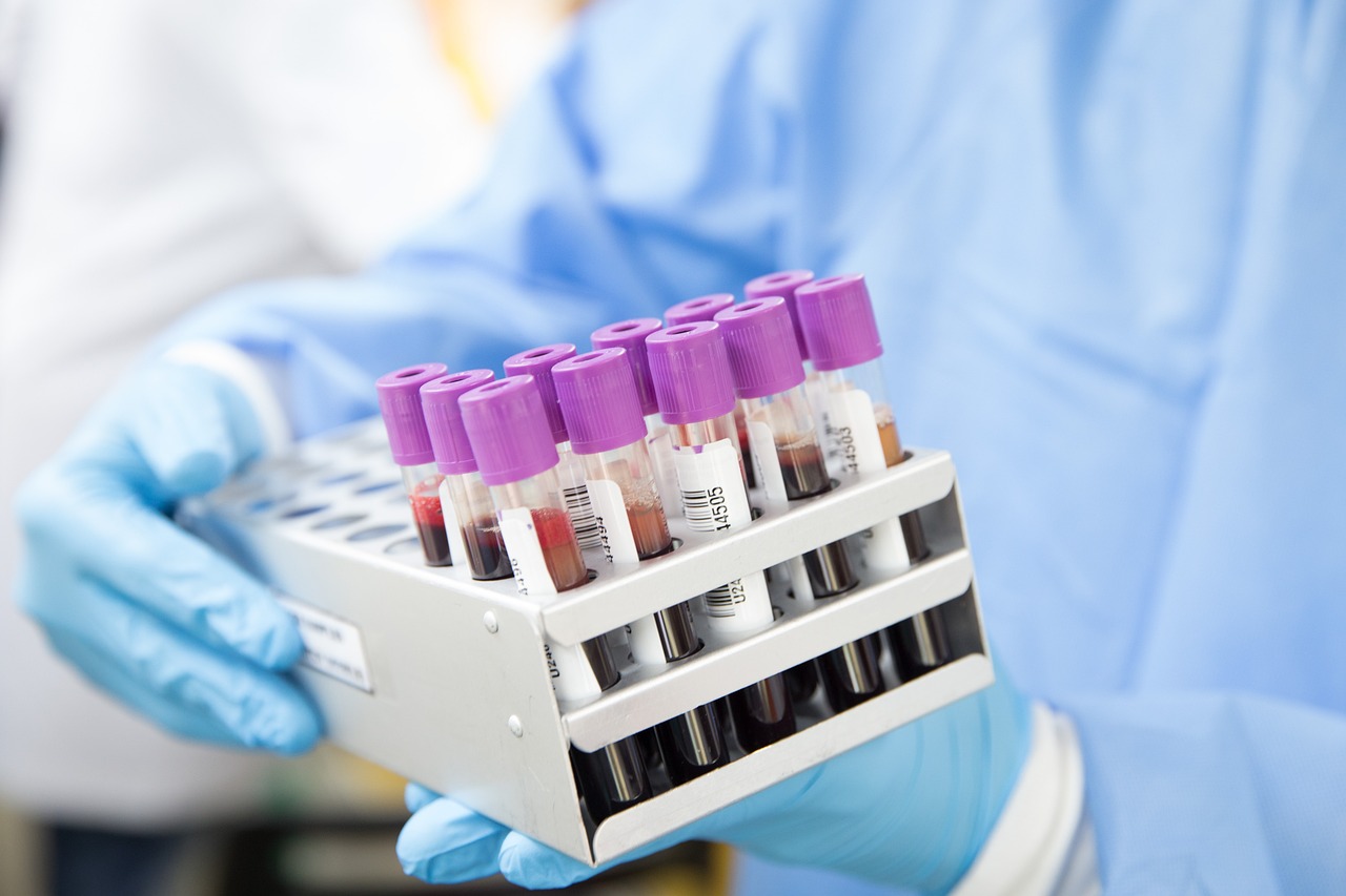 Buisjes bloed in een laboratorium voor diagnostisch onderzoek