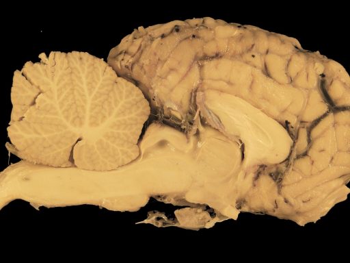 Anatomisch model van de hersenen met zichtbare structuren waaronder de kleine hersenen achterin de schedel