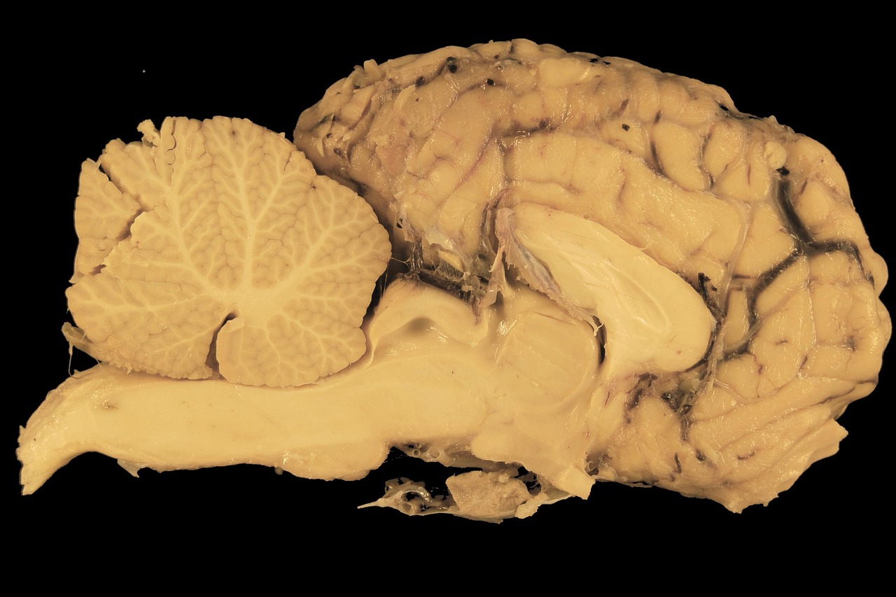 Anatomisch model van de hersenen met zichtbare structuren waaronder de kleine hersenen achterin de schedel